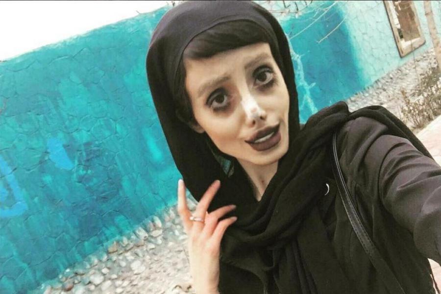 إيرانية أجرت 50 عملية جراحية لتبدو مثل «أنجلينا».. هل النتيجة كما تمنت؟